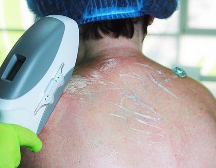 Hardware cosmetology in cosmetology "Touch Light Cosmetology" Kiev. Sign up for hardware cosmetology at a discount.