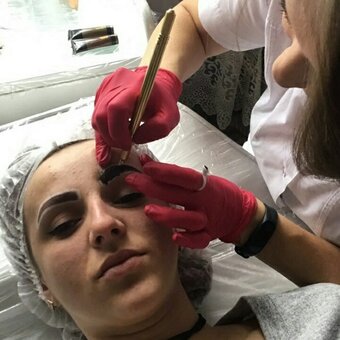 Мікроблейдінг