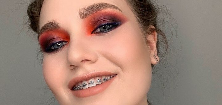 Tooth alignment with braces &quot;orthodontic studio&quot; in kiev. sign up for a discount.