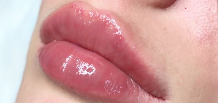 Косметологічний кабінет Олени Кузьменко в Києві. процедури зі знижкою.