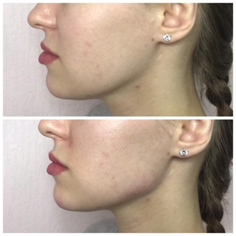 Косметолог Олена Кузьменко в Києві. процедури для шкіри акції.