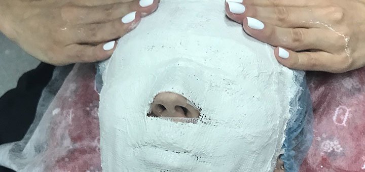 Гіпсовий модельяж для обличчя у косметолога Олени Багрянцевої-Довбиш у Києві. Записуйтесь на прийом до косметолога за знижкою.