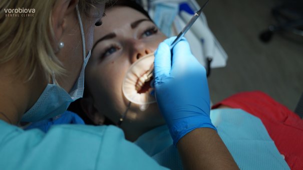 Лікування зубів у стоматології доктора Воробйової у Дніпрі. Записуйтесь до стоматолога з акції.