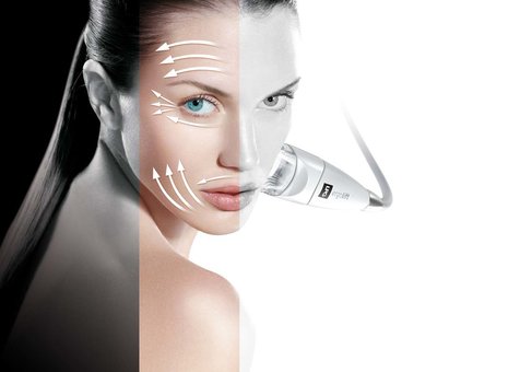 LPG lifting facial massage in the beauty salon "Mont Blanc" in Kiev. Sign up for the procedure for the promotion.