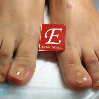Лікування грибка у студії «E-Studio» у Харкові. Записатися зі знижкою